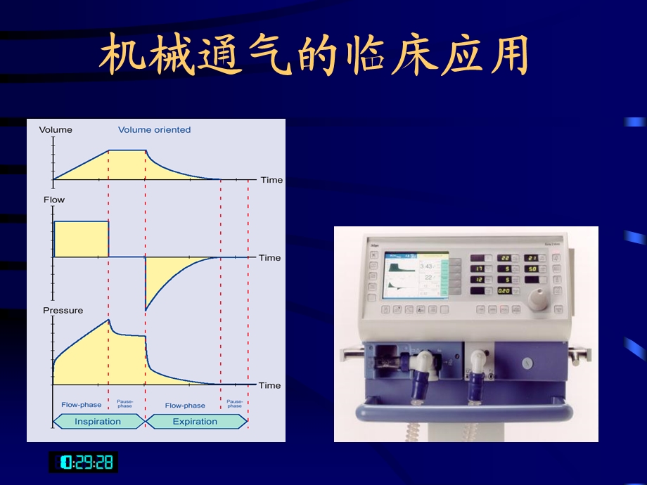 呼吸机临床应用-基础知识.ppt_第1页