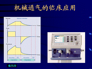 呼吸机临床应用-基础知识.ppt