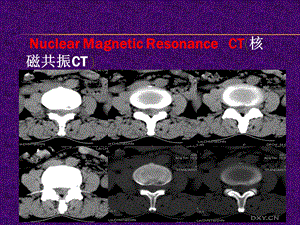 层析成像及其有关知识.ppt