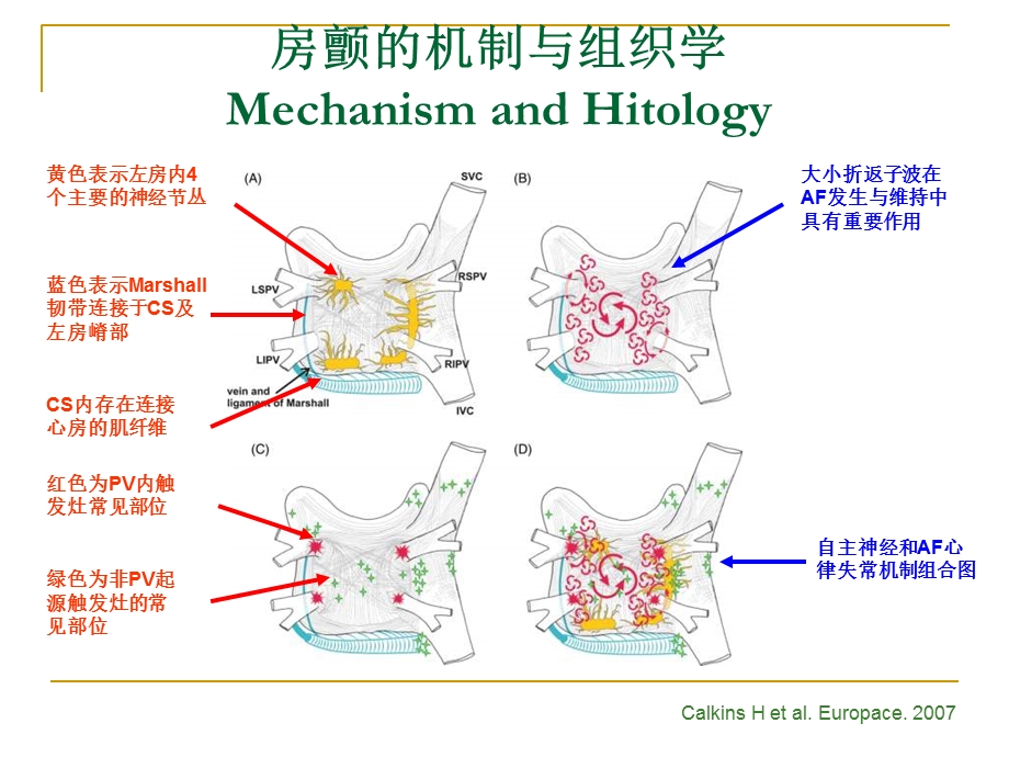 持续性心房颤动的导管消融策略.ppt_第3页