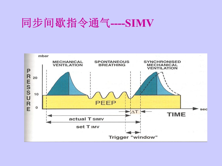 机械通气基础与基本临床应用.ppt_第2页