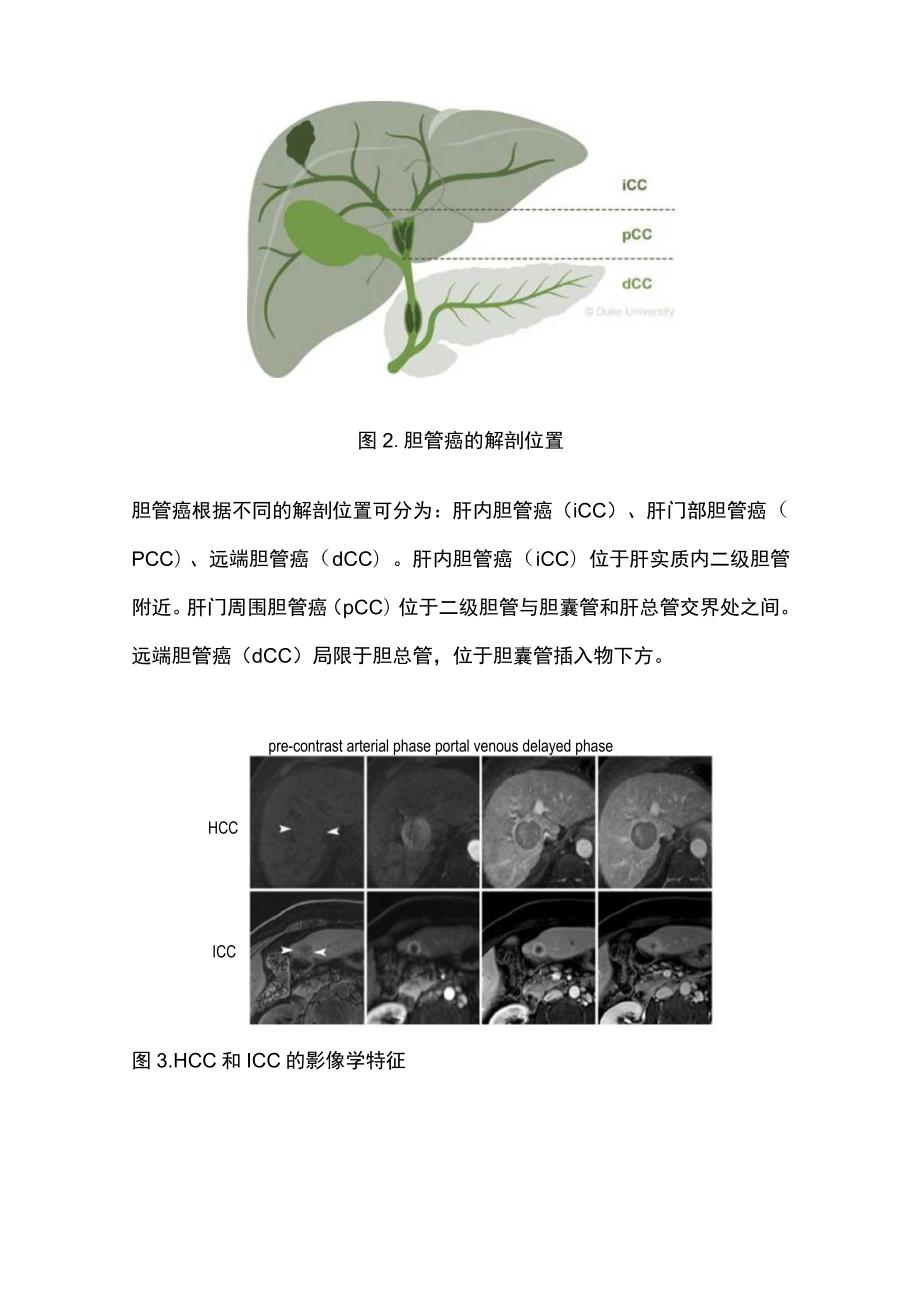 2023肝内胆管癌治疗进展：临床医生当前和未来治疗前景概述.docx_第3页