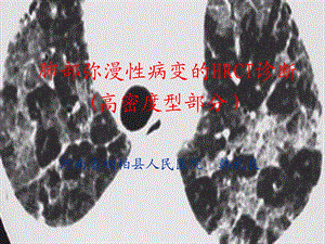 肺部弥漫性病变的HRCT诊断片状高密度影部分.ppt