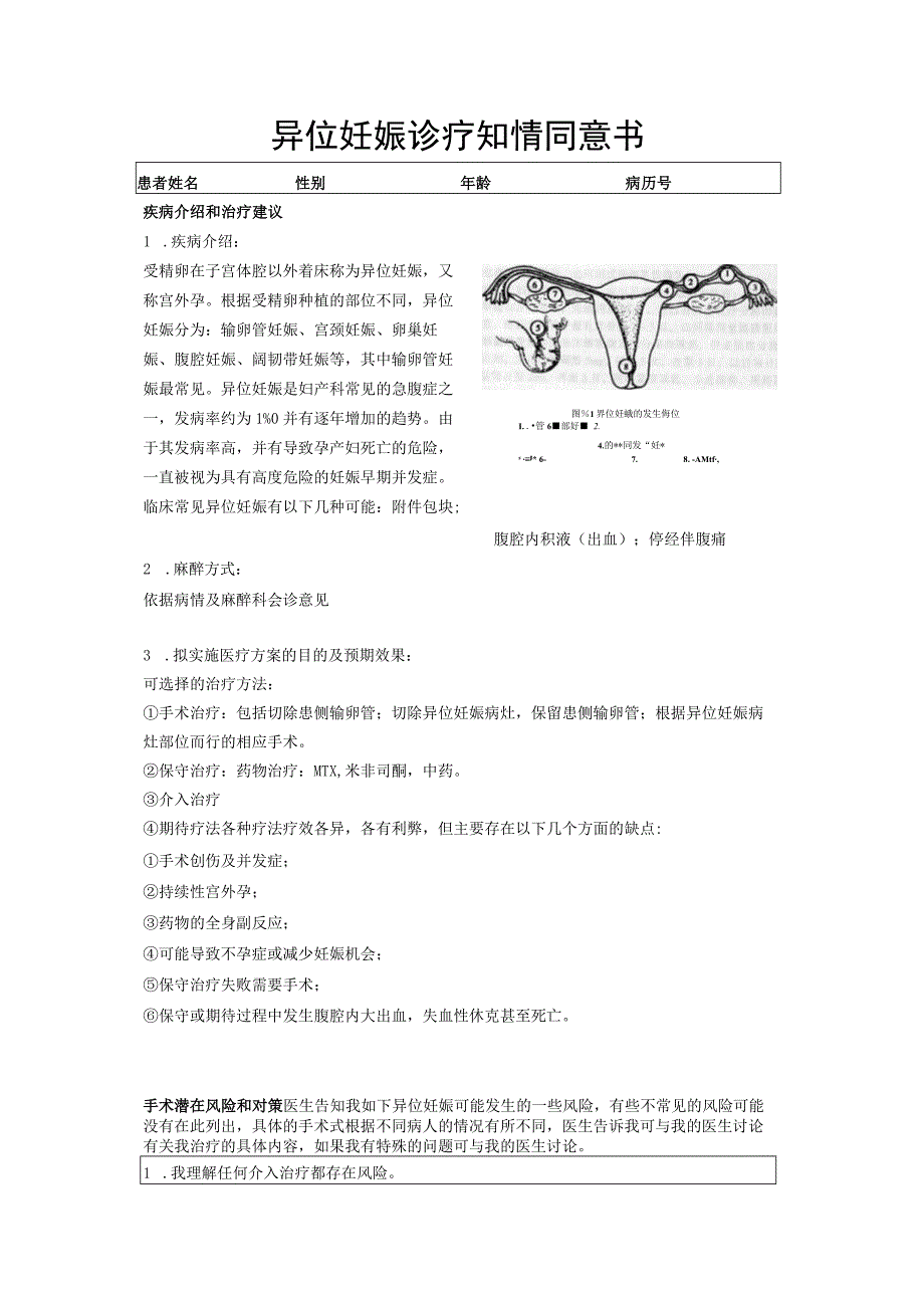 异位妊娠诊疗知情同意书.docx_第1页