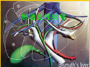 胆道良性狭窄.ppt