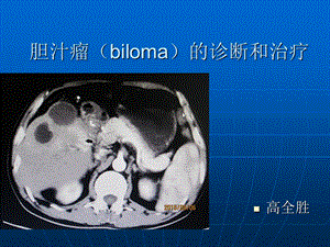 胆汁瘤biloma的诊断和治疗.ppt