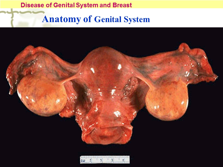 病理学生殖系统疾病.ppt_第3页