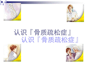 骨质疏松0业务学习.ppt