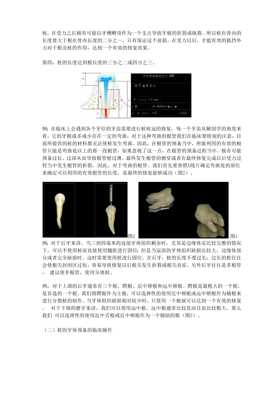 大面积牙体缺损新进展.docx_第2页