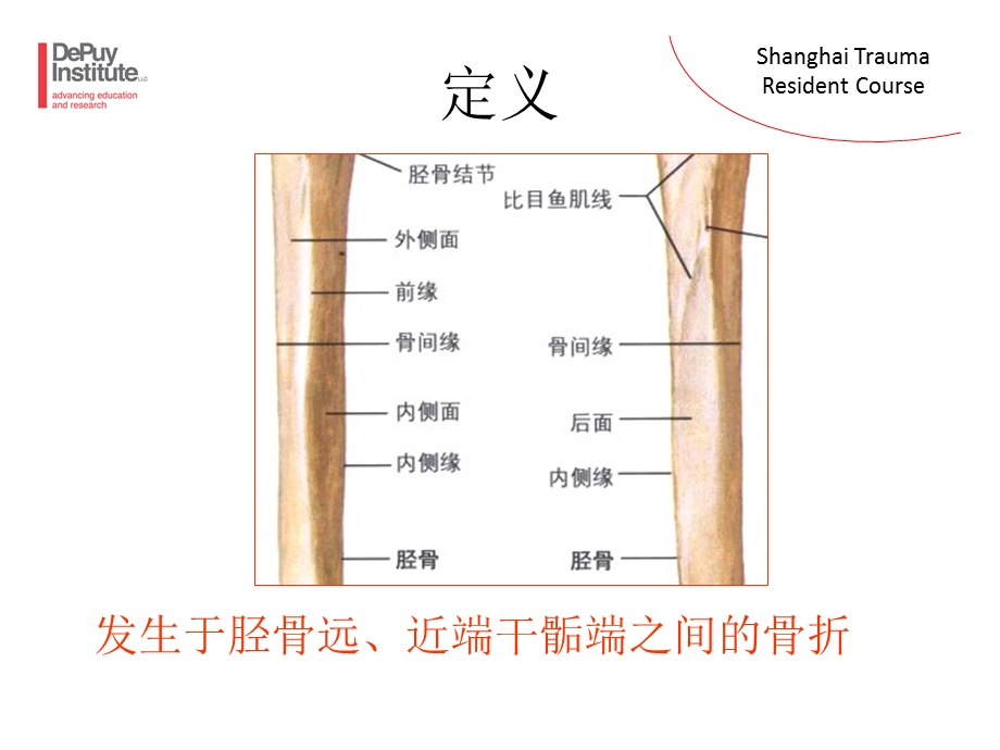 胫骨干骨折包括骨筋膜室综合征ppt课件.ppt_第2页