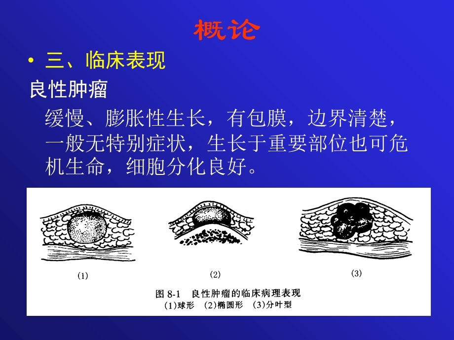 口腔颌面部常见肿瘤.ppt_第3页