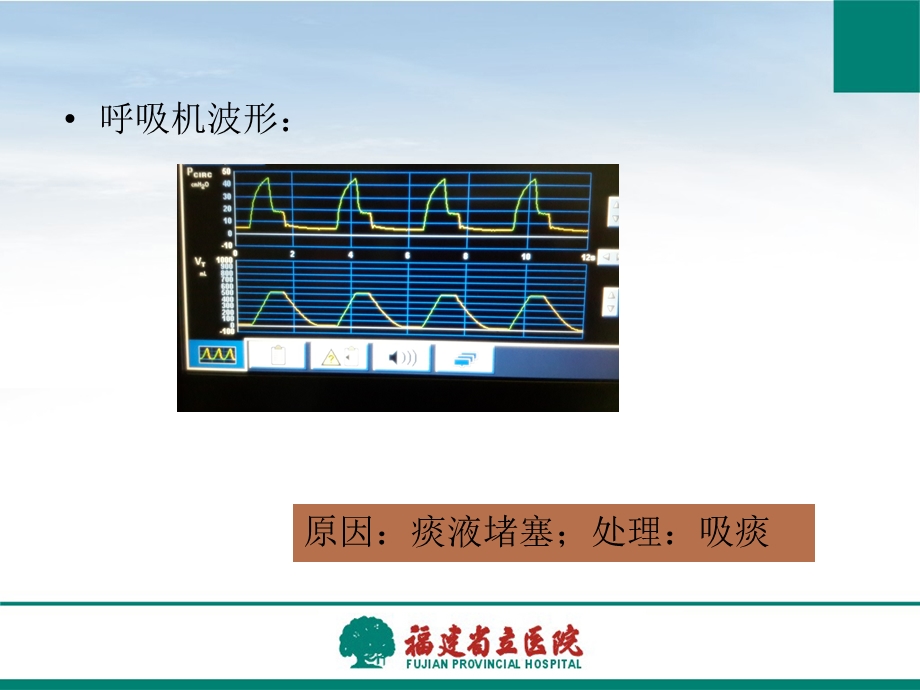 陈凯常用呼吸机报警及故障的排除ppt课件.ppt_第3页