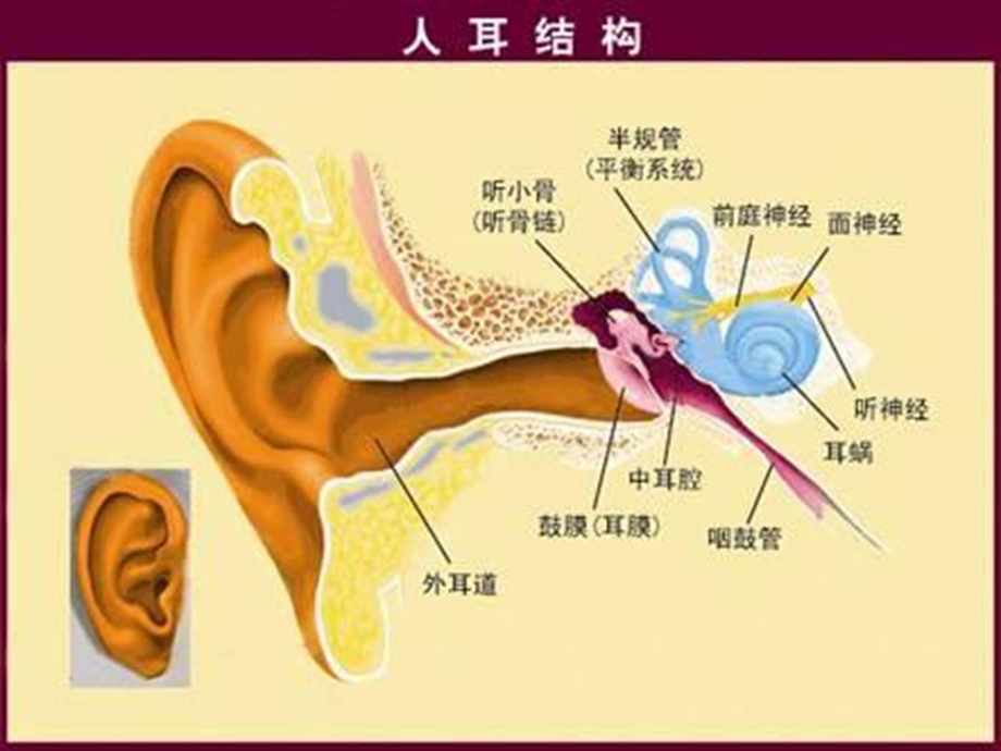 听神经瘤护理查房.ppt_第3页