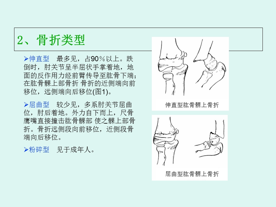 肱骨髁上骨折病人护理.ppt_第3页