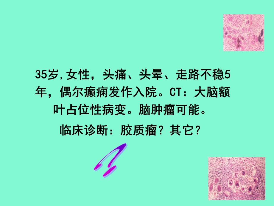 寄生虫病不考.ppt_第1页