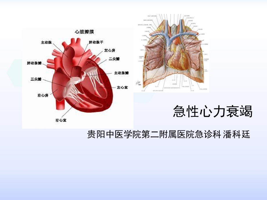 急性心力衰竭中西医临床危重病学.ppt_第1页