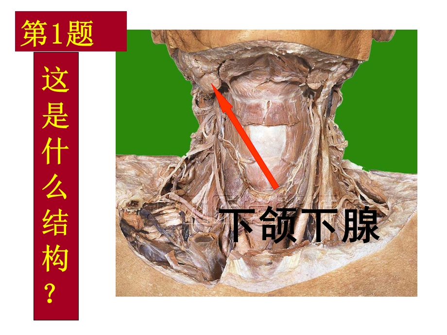 套题标本复习题标注.ppt_第3页