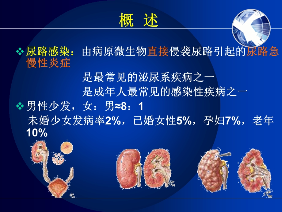 尿路感染第八版内科学.ppt_第3页