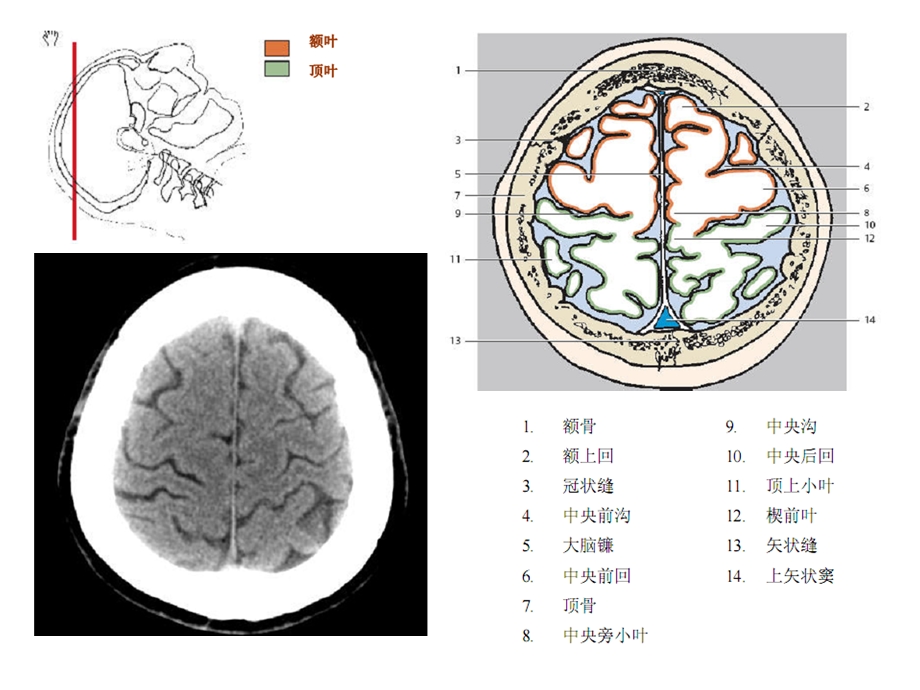 头颈CTMRI解剖图解系列1.ppt_第3页