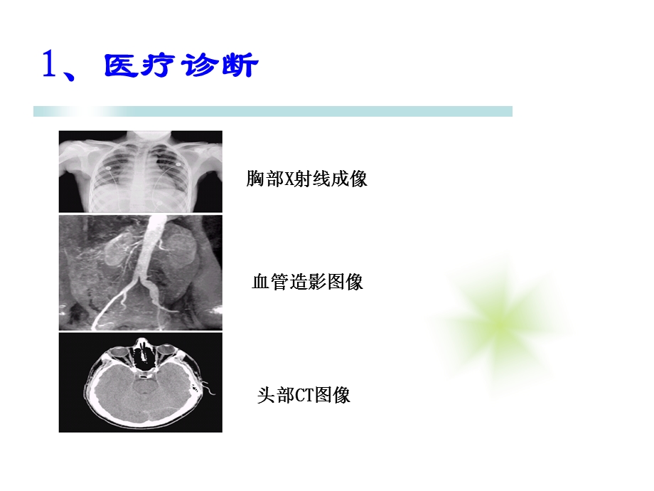 数字图像处理应用实例.ppt_第2页