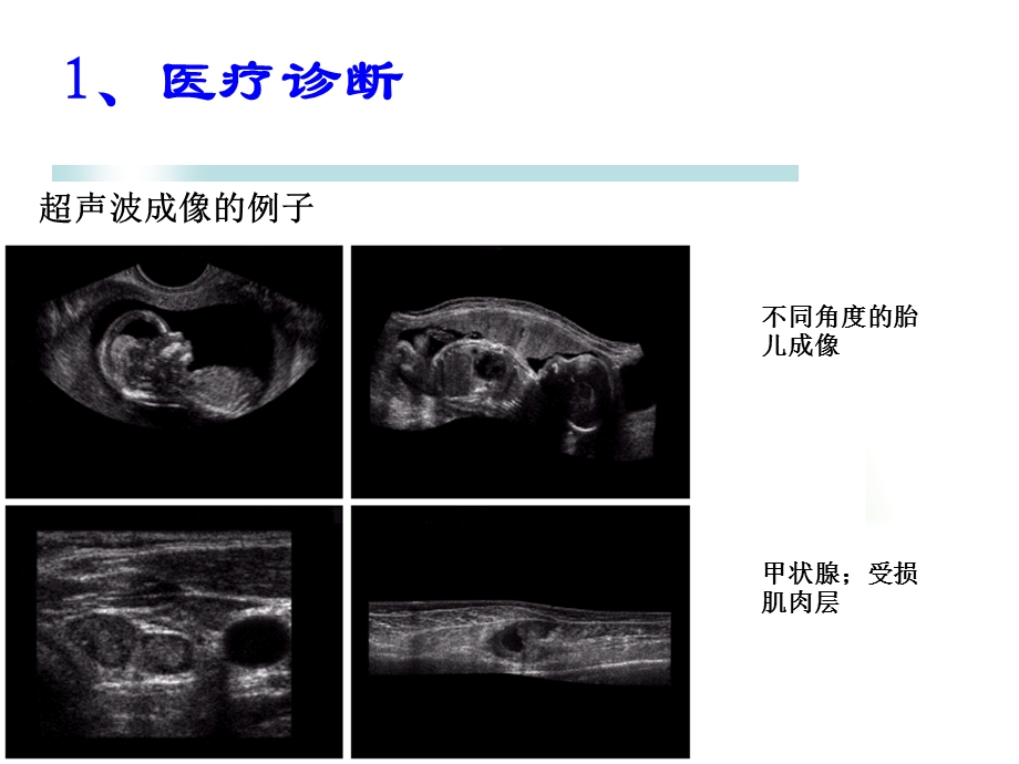 数字图像处理应用实例.ppt_第3页