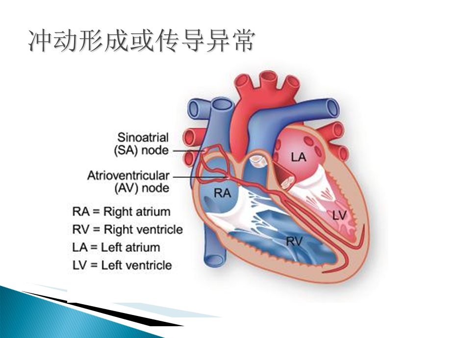 手术麻醉期心律失常.ppt_第2页