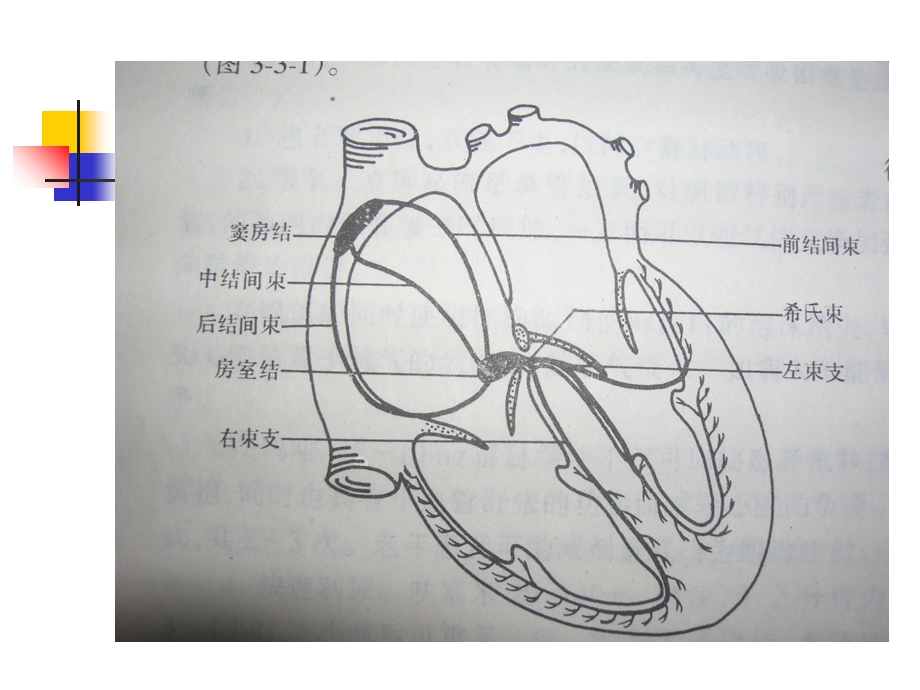 常见心律失常的心电图表现与解读.ppt_第2页