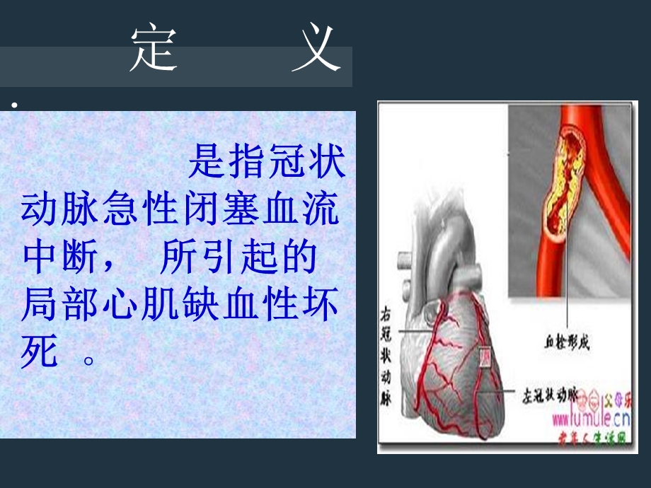 急性心肌梗死抢救护.ppt_第3页