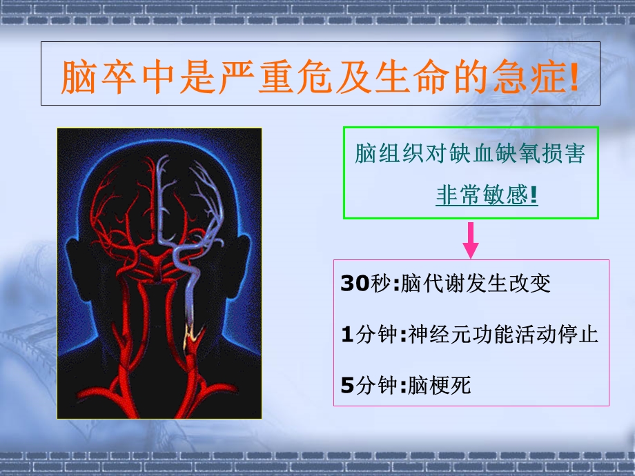 急性脑梗死静脉溶栓的护理查房.ppt_第3页