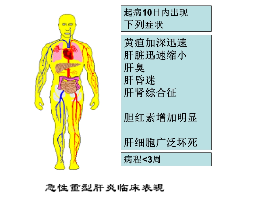 急性重症肝炎临床表现.ppt_第1页