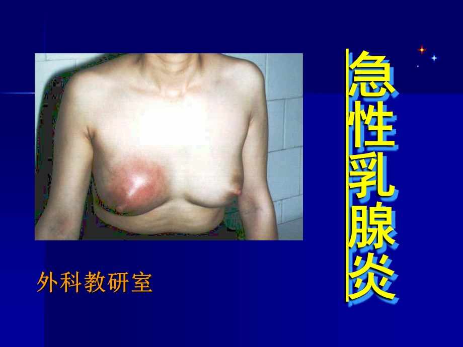 急性乳腺炎外科治疗.ppt_第1页