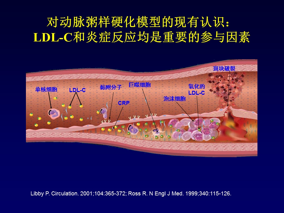 规范化调脂治疗—2007中国成人血脂异常治疗指南解读(PPT-37).ppt_第2页