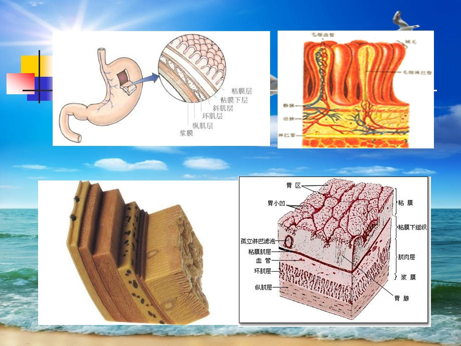 消化内镜治疗新技术.ppt_第3页