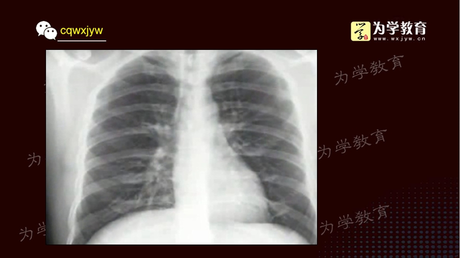 a2普通x线影像诊断.ppt_第2页