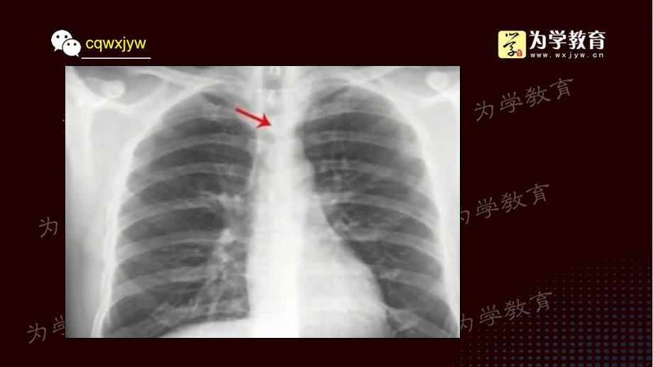 a2普通x线影像诊断.ppt_第3页