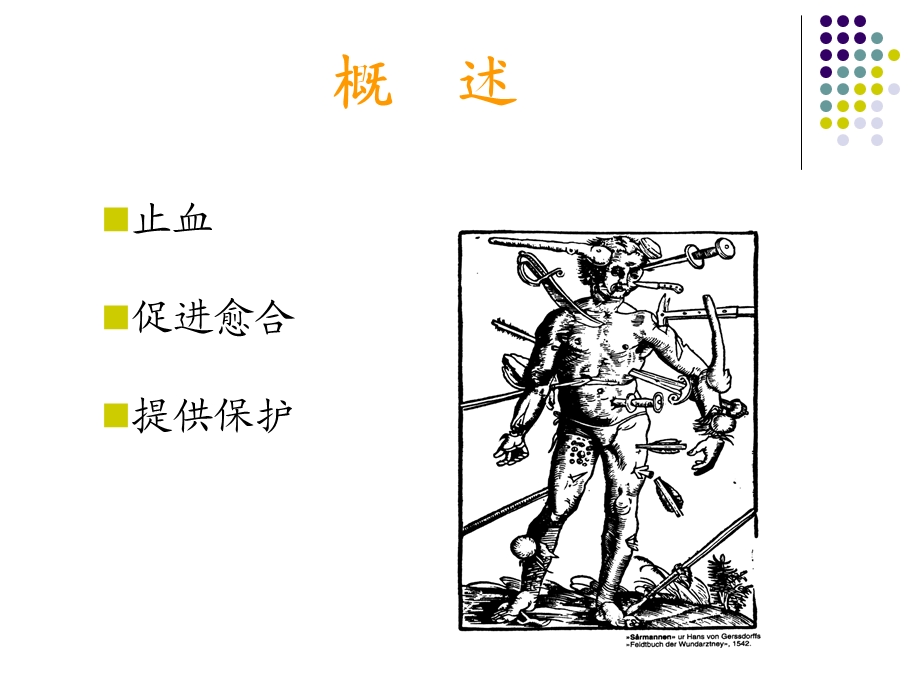 敷料的分类与选择.ppt_第2页