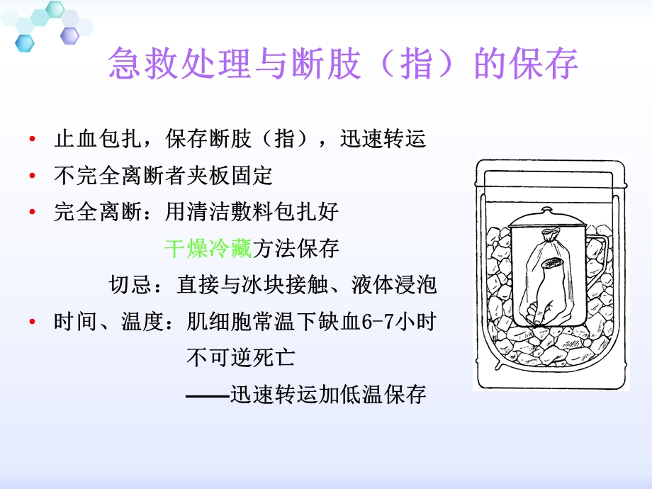 断指再植及血运观.ppt_第2页