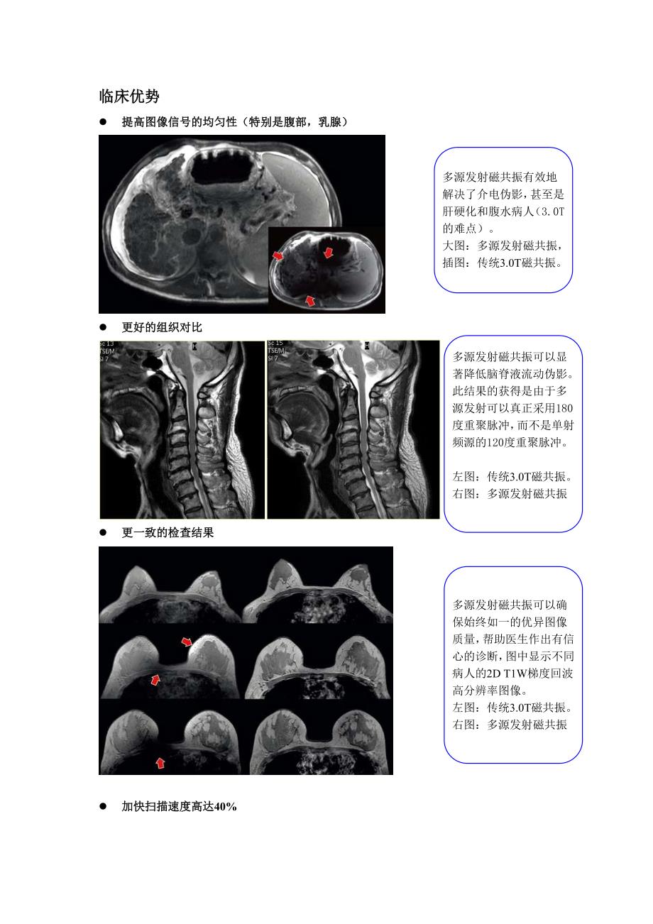 飞利浦全新Achieva 3.0T TX多源发射磁共振特点介绍.doc_第2页