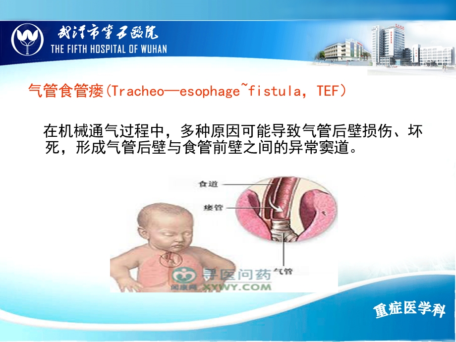 气管食管瘘的原因分析和预防措施.ppt_第2页