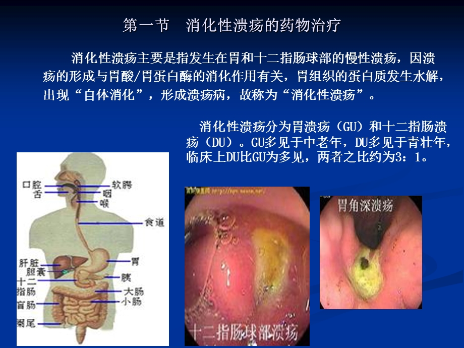 消化系统常见疾病的药物治疗.ppt_第2页