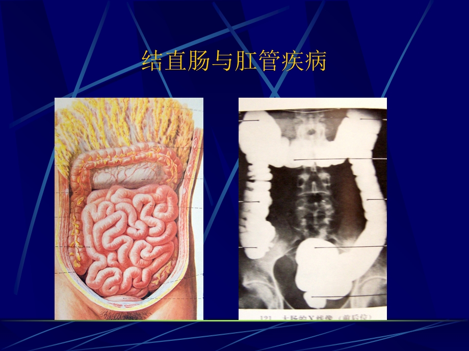 结直肠与肛管疾病之结直肠与肛管疾病.ppt_第3页