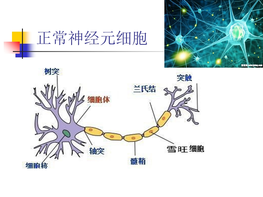 多发性硬化-课件.ppt_第3页