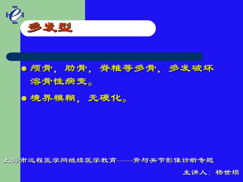 脊柱肿瘤的影像学诊断3.ppt_第1页