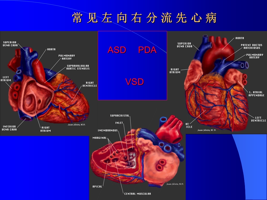 先天性心脏病血流动力学.ppt_第2页