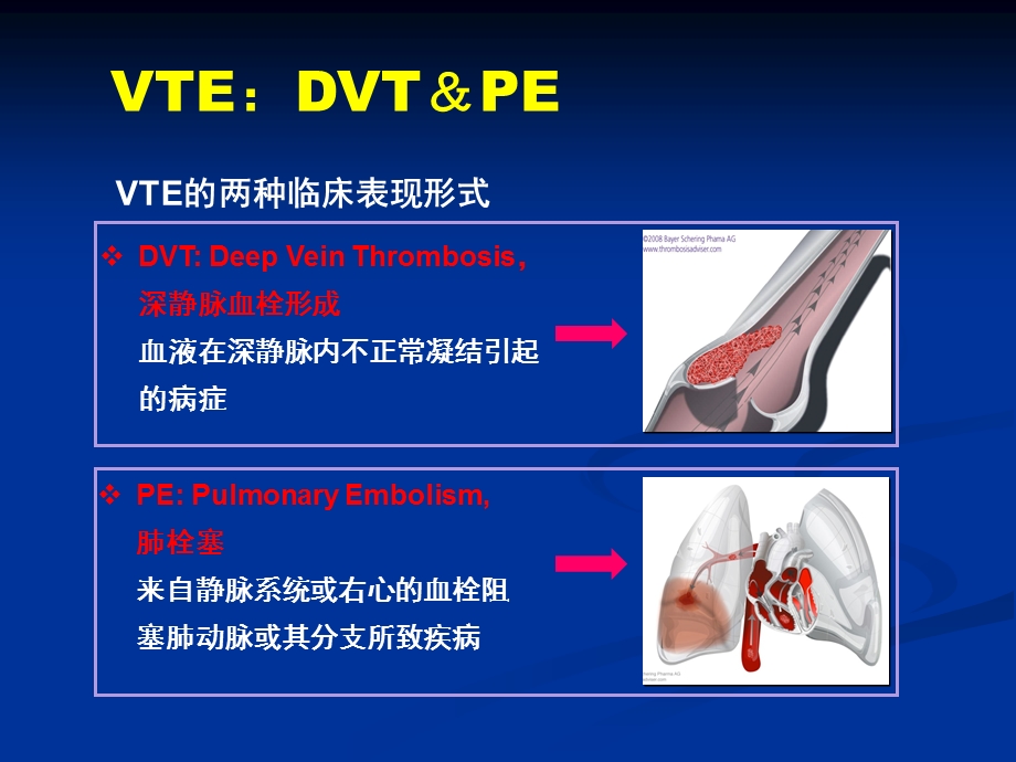 下肢深静脉血栓形成的诊断和治疗ppt课件.ppt_第2页