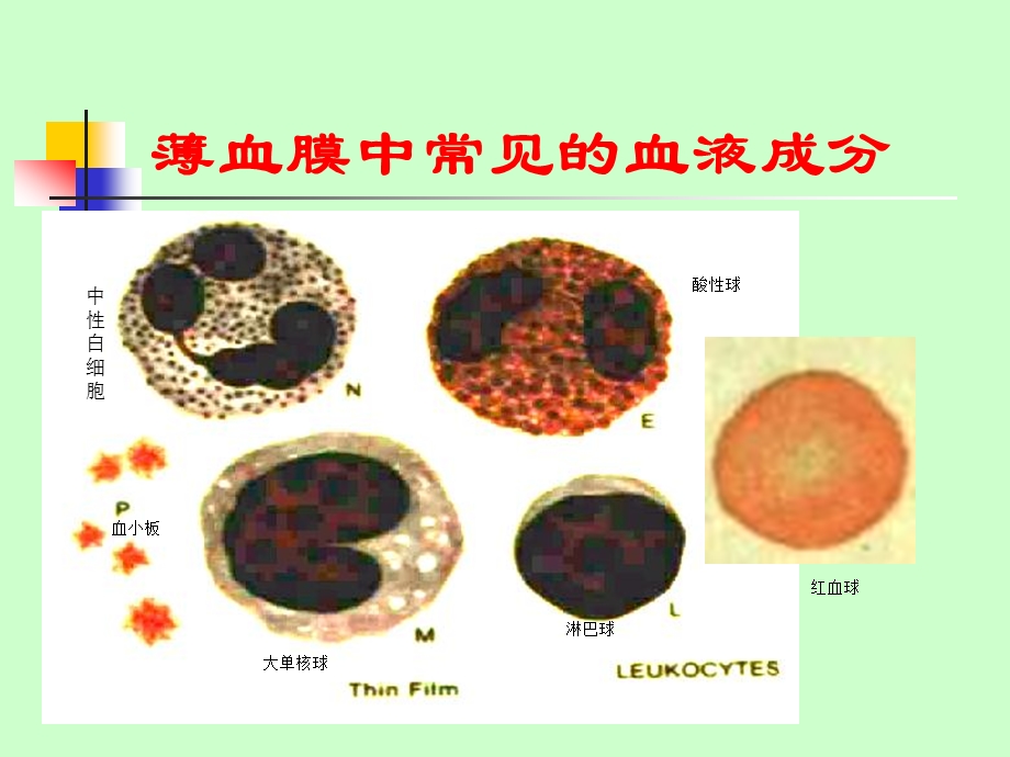 疟原虫的形态鉴别厚薄.ppt_第2页