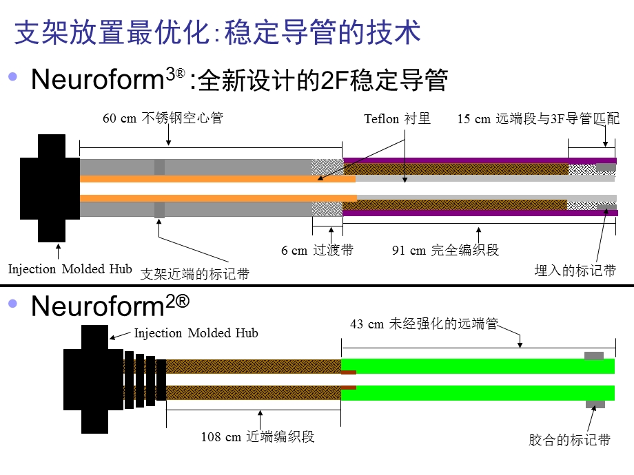 神经介入支架植入术选择.ppt_第2页