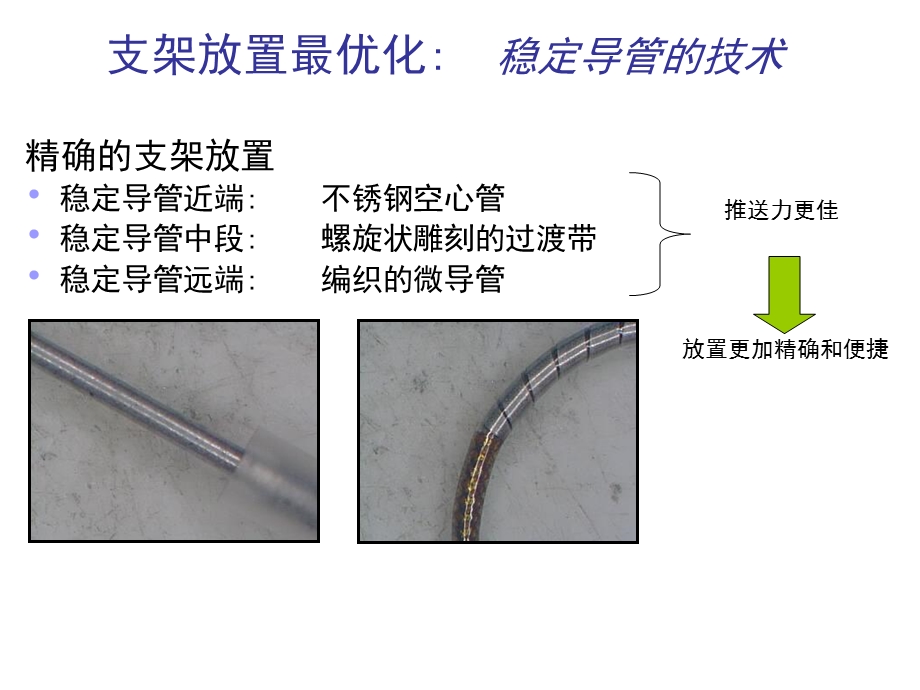 神经介入支架植入术选择.ppt_第3页