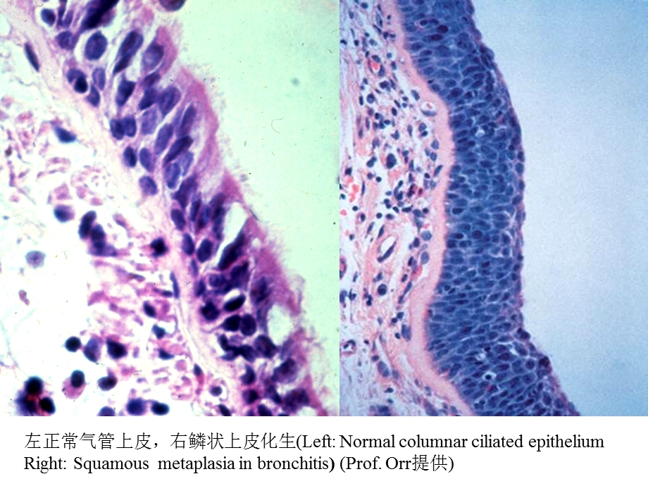 病理学实验教学组织切片示教图选.ppt_第3页