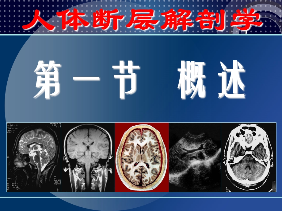 人体断层解剖学胸部断层解剖PPT课件.ppt_第3页